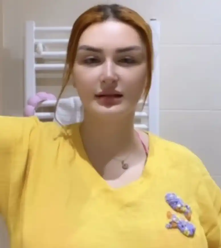 صورة لرانيا التومي بعد عمليات التجميل 